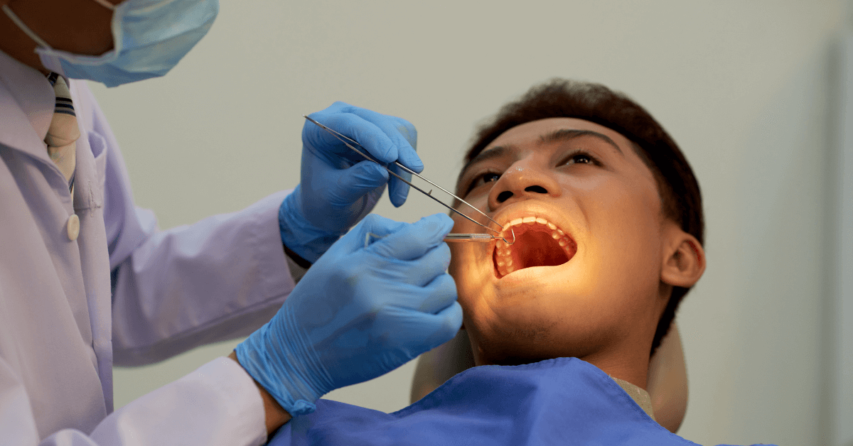 Tooth Extraction: What You Need to Know